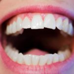 Mocne i zdrowe zęby – sposób na piękny uśmiech
